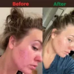 Puritan’s Pride Zinc for Acne 100 Tablets - Image 4